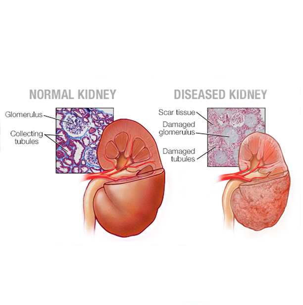 Kidney Specialist in Una