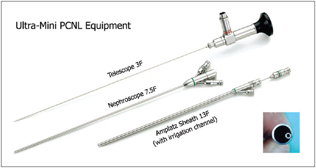 RIRS MINI MICRO PCNL