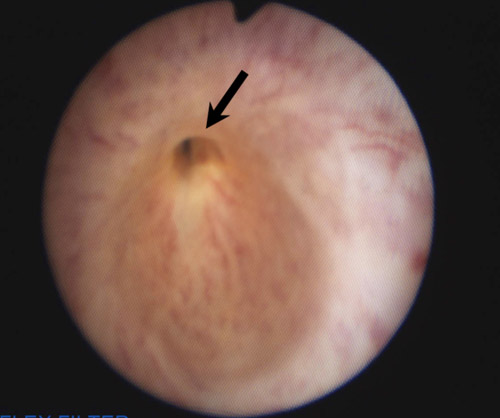 Laparoscopic Urology 